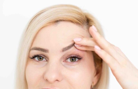 Get Rid Of Your Droopy Eyelids Easily