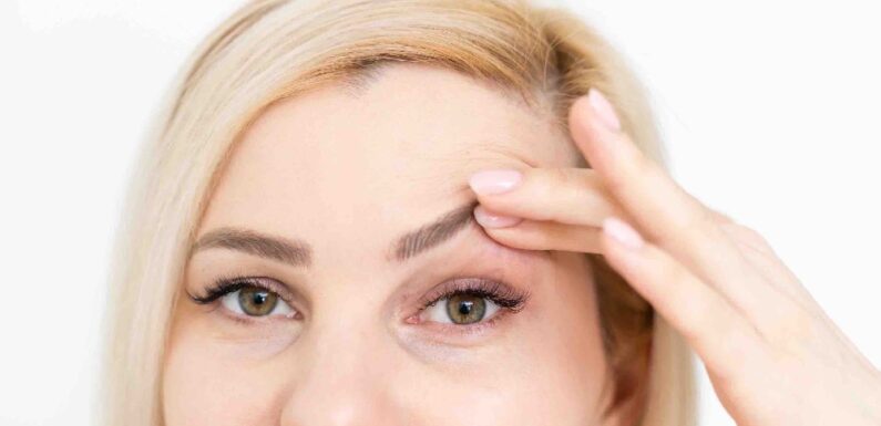 Get Rid Of Your Droopy Eyelids Easily