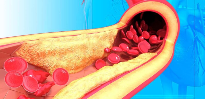 Familial Hypercholesterolemia and Atherosclerosis: The Inherited Risk