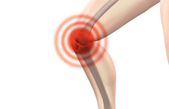 What to Do After a Knee Replacement Surgery