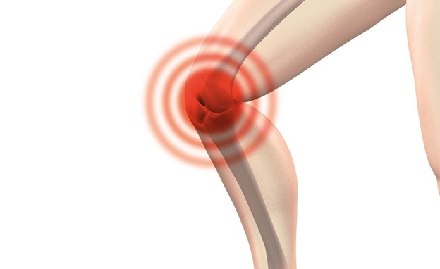 What to Do After a Knee Replacement Surgery