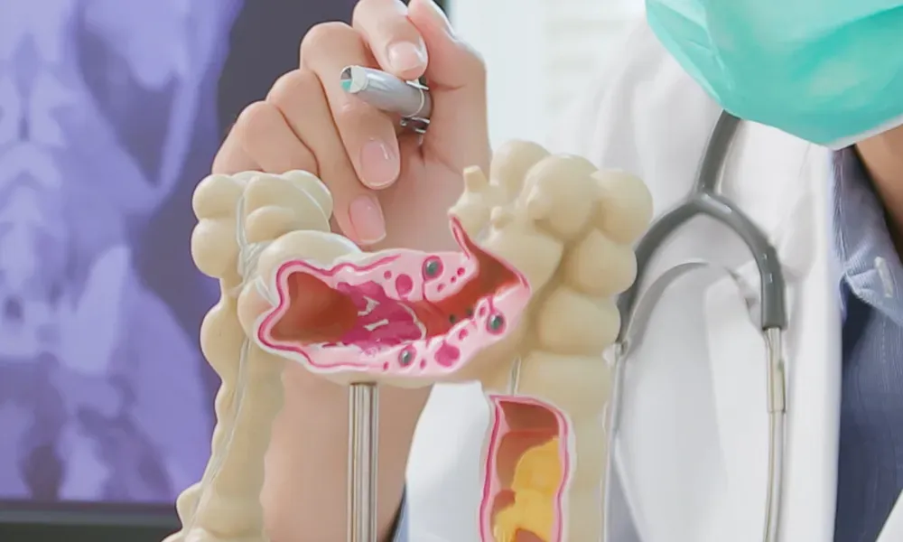 Cancer in the Colon? Understand it better