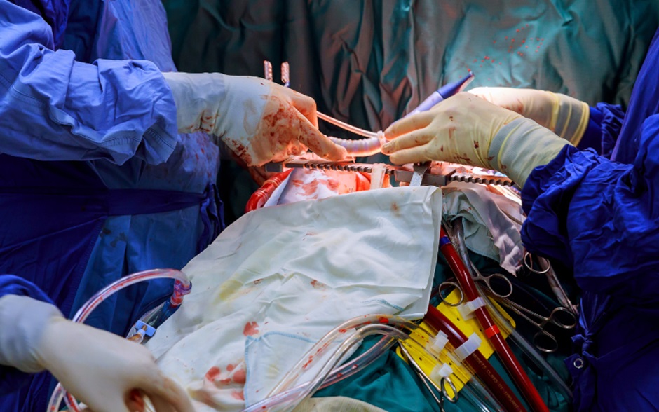 Coronary Angioplasty