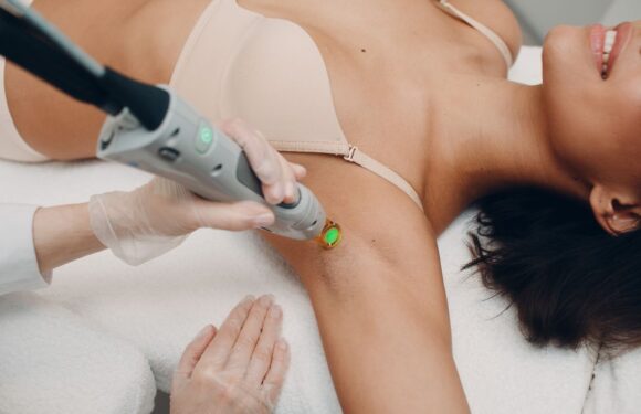 Is Laser Hair Removal Permanent or Just Long-Lasting?