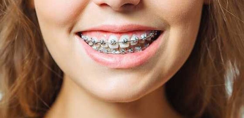How Local Climate Impacts Orthodontic Care: A Deep Dive into Braces in Minot, ND