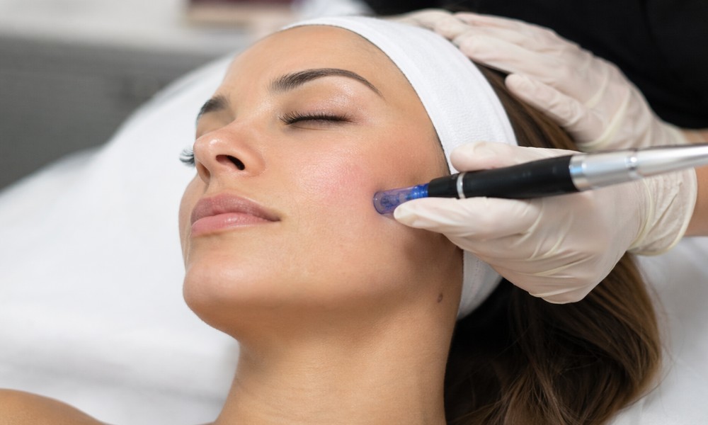 What to Know About Microneedling Before Your First Treatment