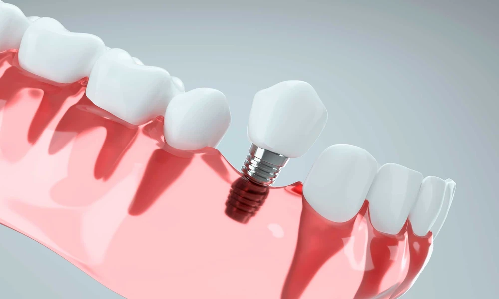 Healthy Smile Healthy Body: The Connection Between Oral Health and Overall Wellness