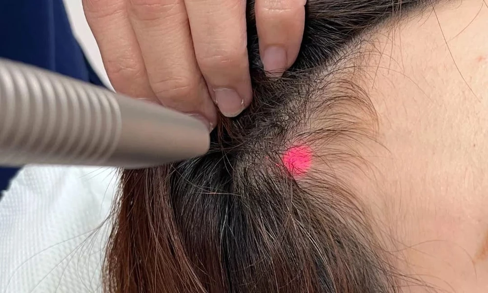 What makes combining laser therapy with growth serums more effective for thinning hair?